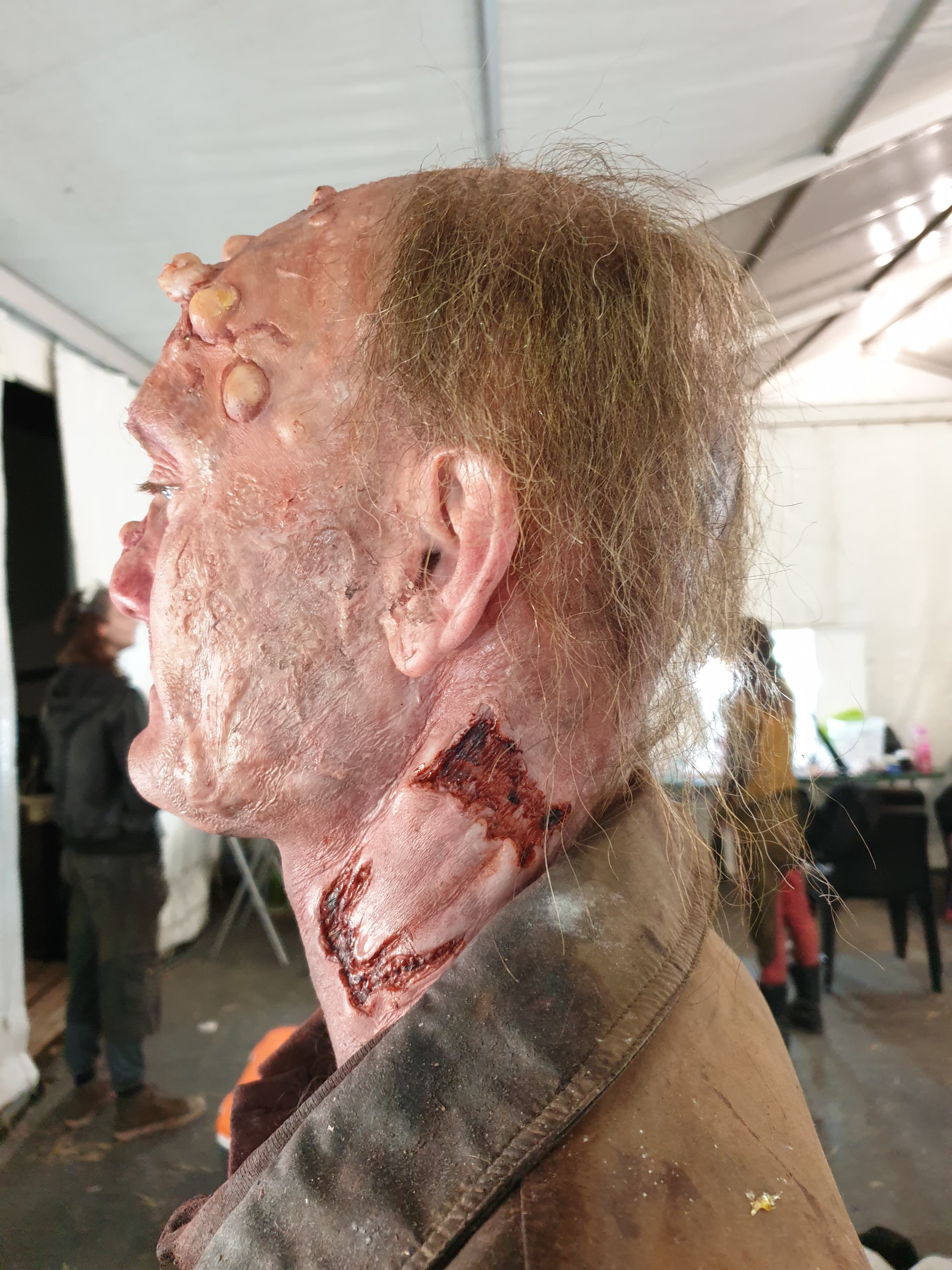 Gore Prosthetic